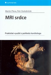 MRI srdce