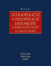 Intraoperační a perioperační endoskopie